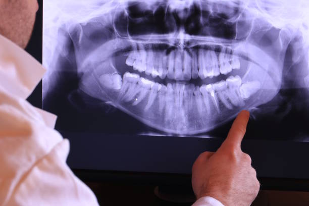 Best Emergency Dental Care for Trauma or Injury in Newport, WA